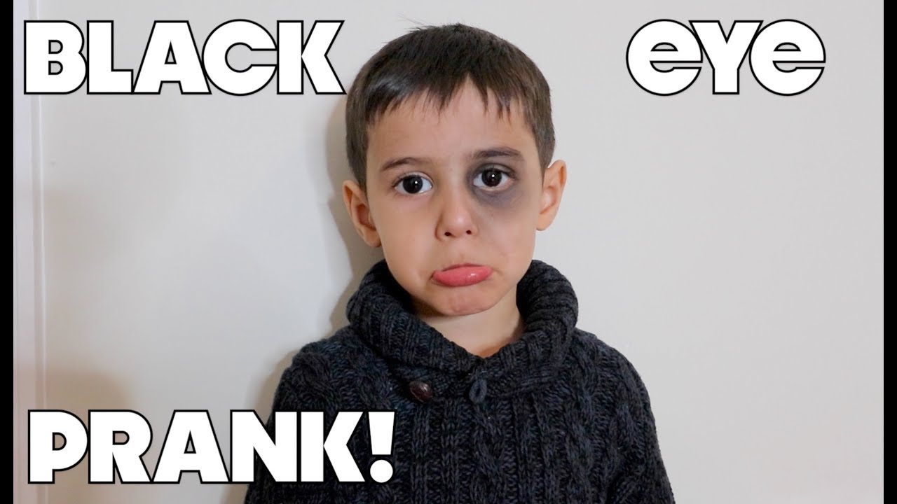I Finally Pranked My Mom!! **Black Eye PRANK** YouTube
