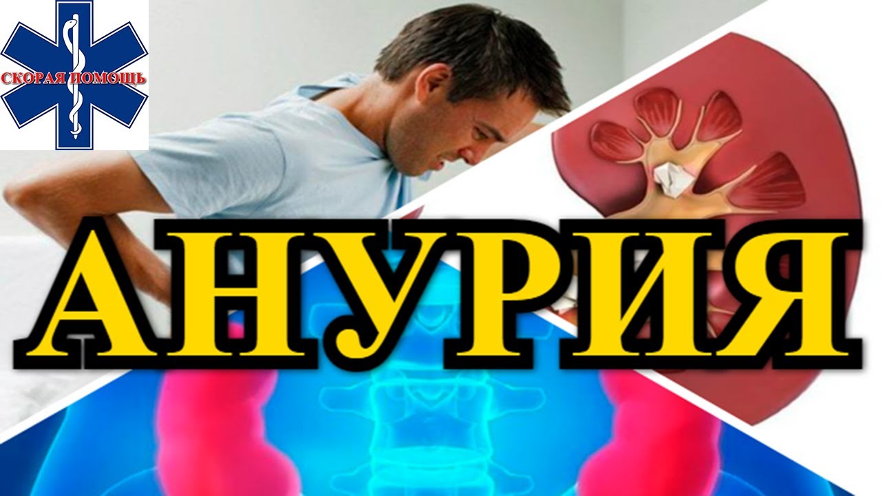 Анурия / Симптомы / Неотложная помощь - YouTube