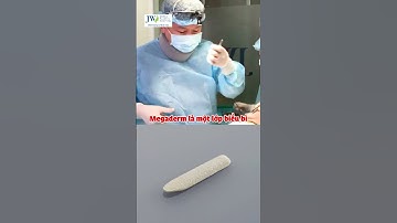 Bác sĩ Tú Dung Nâng mũi Sụn sườn giải cứu chiếc MŨI VẸO LÒI SỤN sau 3 lần nâng mũi ở spa