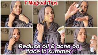 Skincare Tips & Home Remedy For Oily & Acne Prone Skin In Summer | Get rid of oily skin naturally