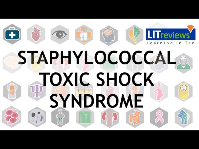 Streptococcal toxic shock syndrome revealed phlegmasia cerulea dolens of  the arm - The Lancet Infectious Diseases