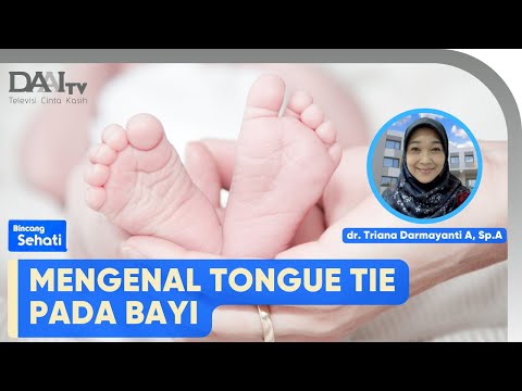 Video: Bisakah tongue tie membuat bayi rewel?