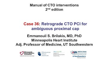 Case 36: Manual of  CTO Interventions - Dual retrograde for proximal cap ambiguity