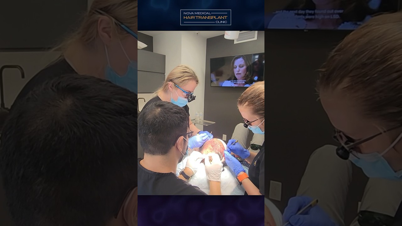 💪🏻Hair Transplant Procedure Overseen By A Top Surgeon / 