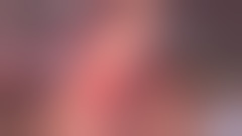 Gastric Antrum GIST   Laparoscopic Atypical Gastrectomy