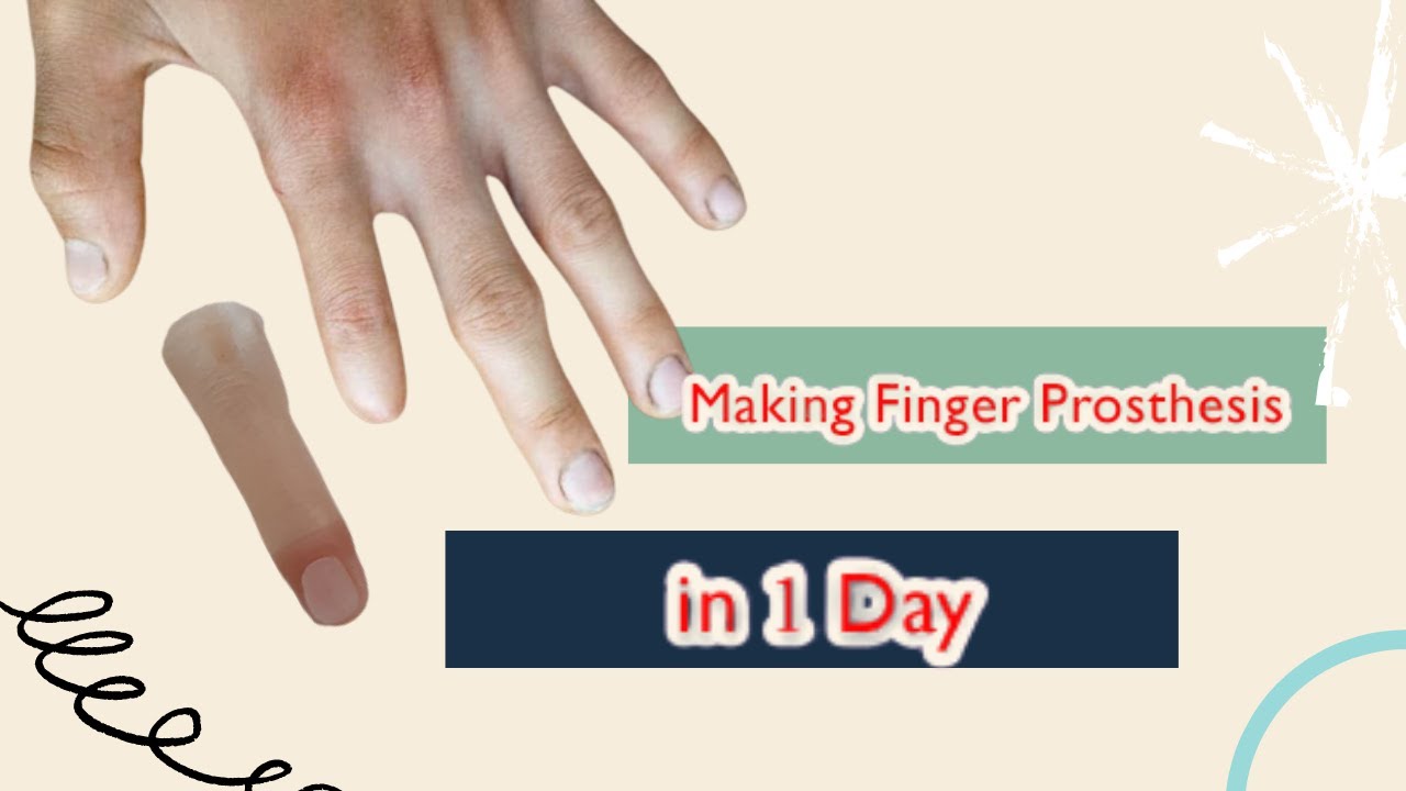 making Finger prosthesis index finger lost prosthesis Custom