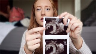 My Doctors think I'm having a MISCARRIAGE...