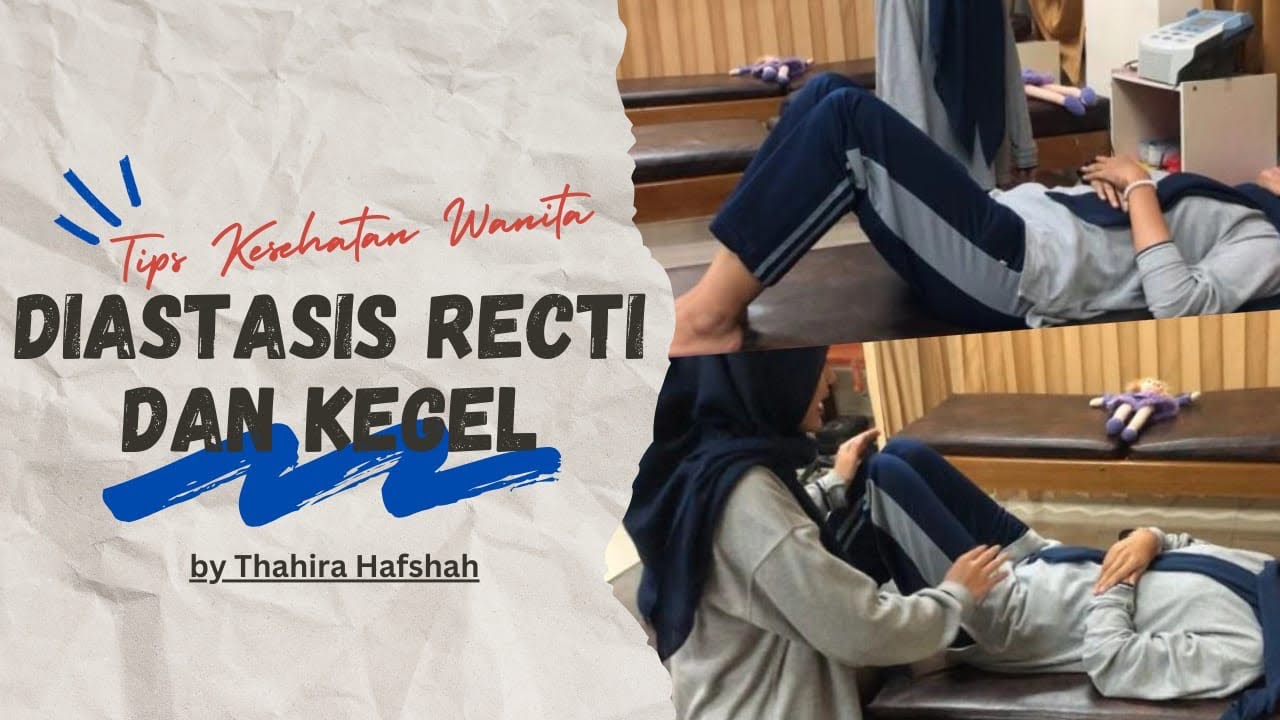 Tips Diastatis Recti & Kegel Untuk Kesehatan Wanita
