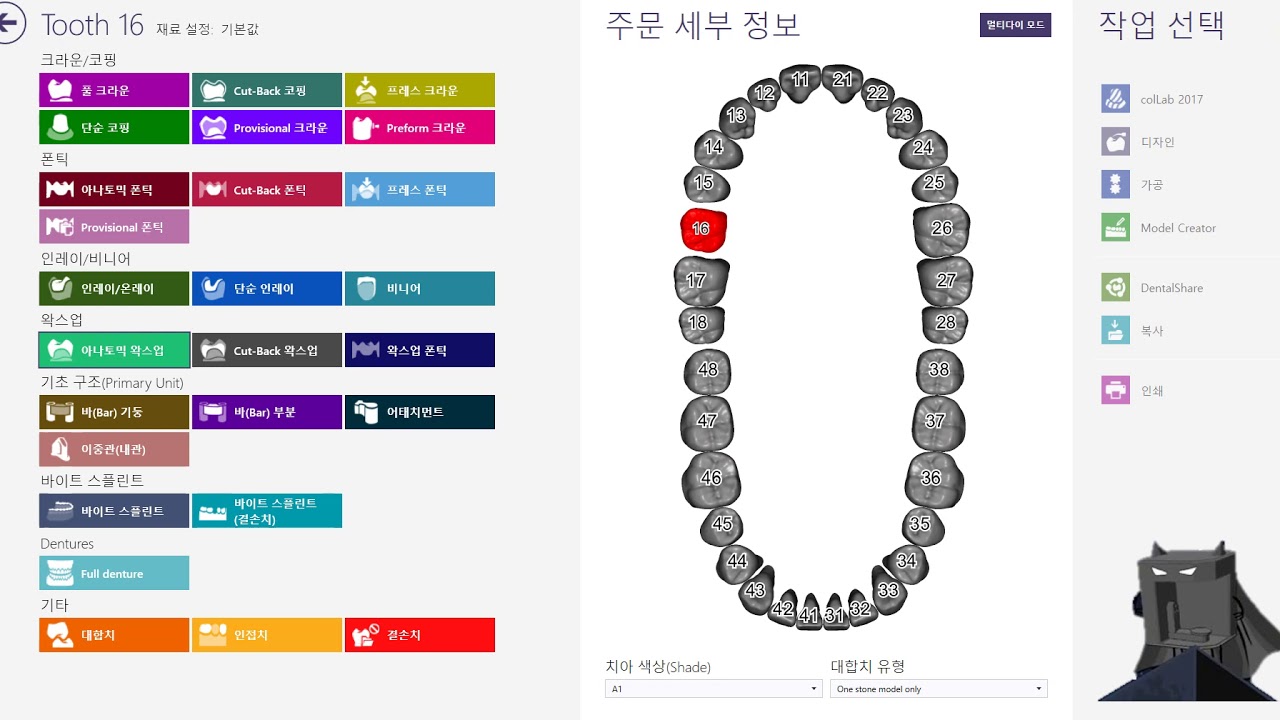 Exocad Tip For Dental Technician_order for digital wax up