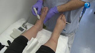 La prevención, el mejor tratamiento para las heridas screenshot 3