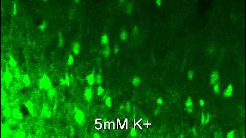 Improved adult brain slice method, Ca imaging (cortex).wmv