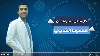 السقوط الشرجي أسبابه و طرق علاجه مع الدكتور #محمد_بلاطة