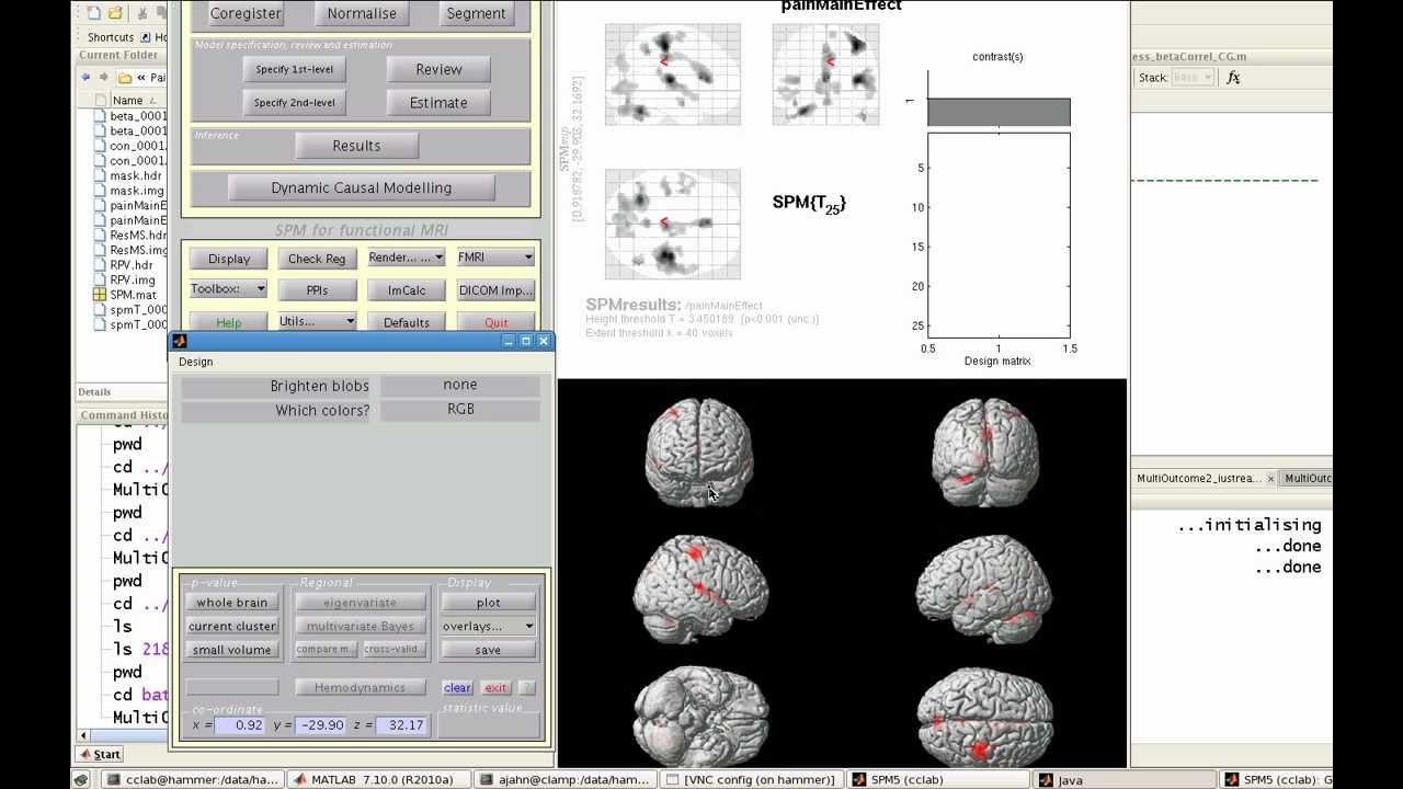 Surface Rendering in SPM