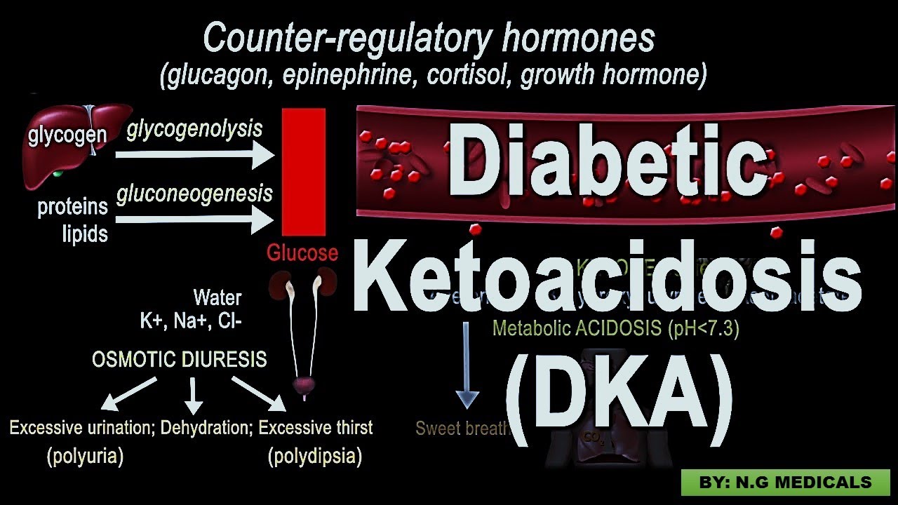 Diabetes Ketoacidosis PART 1 | FULL EXPLANATION IN HINDI BY N.G MEDICALS