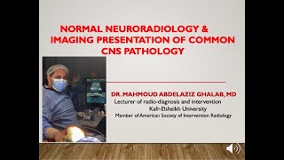 Normal neuroradiology & Imaging presentation of common CNS pathology- Undergraduate lecture