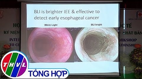 THVL | Việt Nam: Tỷ lệ mắc ung thư tiêu hóa gan mật cao