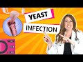 Yeast Infections, 8 interesting facts you didn't know