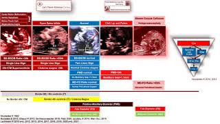 Midsagittal View - Measurement Of Nuchal Translucency - Potentially Detectable Defects - 11 to 13wks screenshot 4