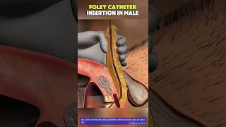 how to insert male catheter #medicalstudent #cathedral #nursing #mbbs #yt #doctor #gnm
