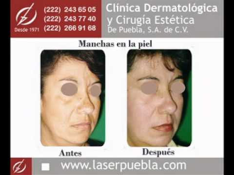 Clnica Dermatolgica y Ciruga Esttica de Puebla - T...