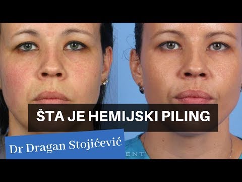 Video: Hemijski Piling Lica: Koje Vrste, Rezultati I Rizici