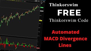 Day Trading Using Auto MACD Divergence Lines For The Stock Market & Thinkorswim!