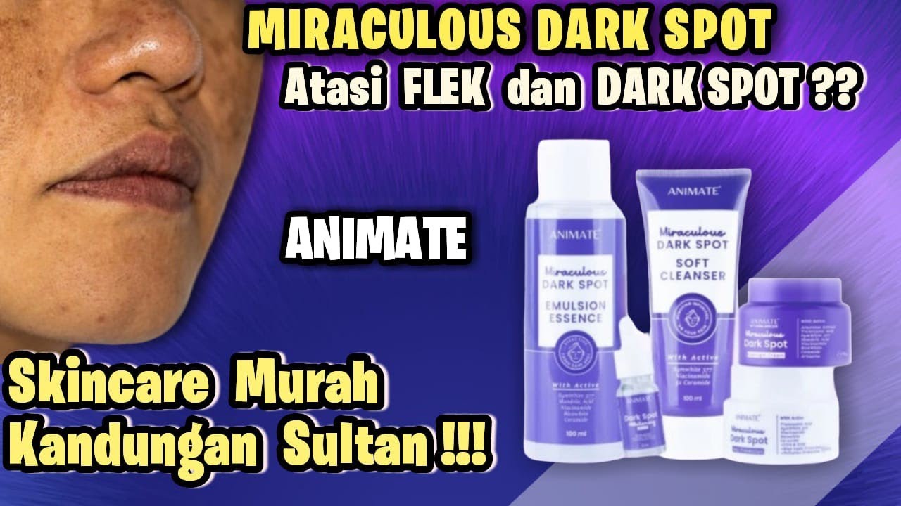 ANIMATE MIRACULOUS DARK SPOT WARNA UNGU UNTUK ATASI FLEK HITAM animate-miraculous-dark-spot-warna-ungu-untuk-atasi-flek-hitam