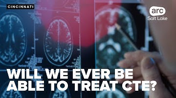 What is the future of CTE research?