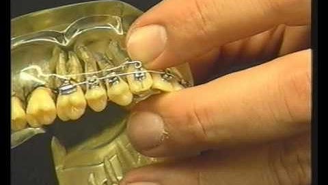 Modeling and Bending Wires - uprighting spring