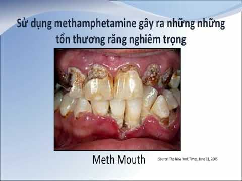 Video: 4 cách để vượt qua cơn nghiện Amphetamine