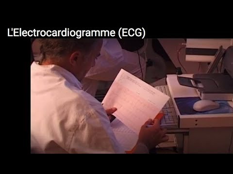 Electrocardiogramme (ECG)