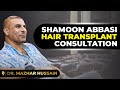 Shamoon abbasi hair transplant consultation with dr mazhar hussain  urdu  dmh