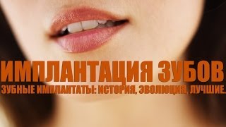 Имплантация зубов Имплантация зубов
