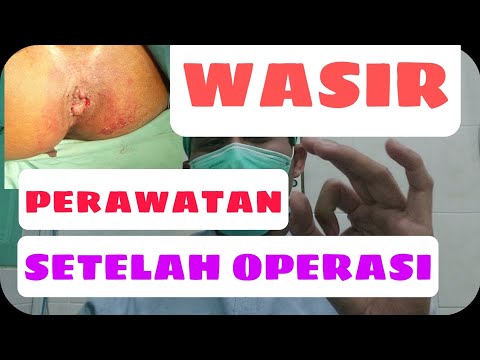 PERAWATAN SETELAH OPERASI AMBEIEN WASIR