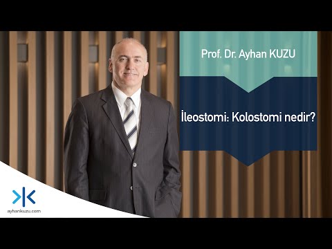 İleostomi - Kolostomi