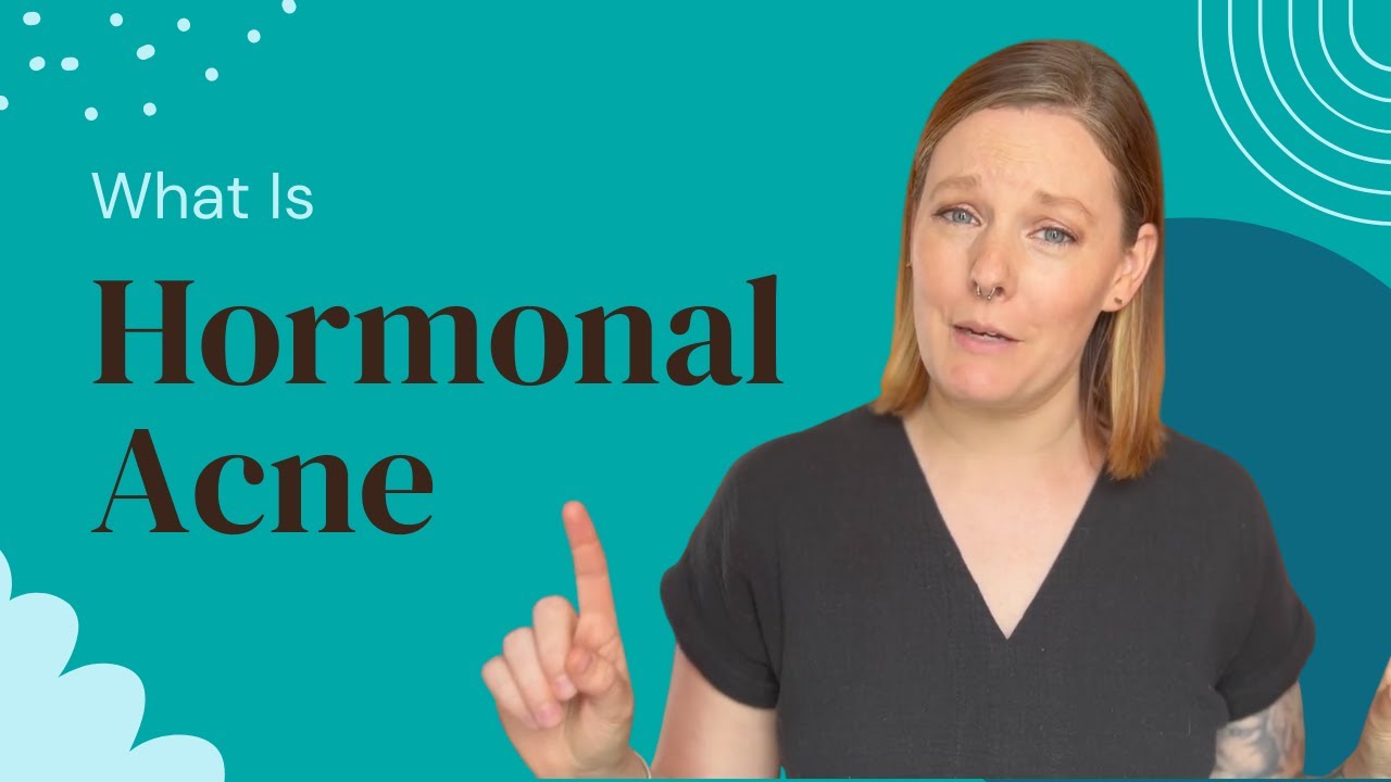 How To Treat Hormonal Acne Naturally