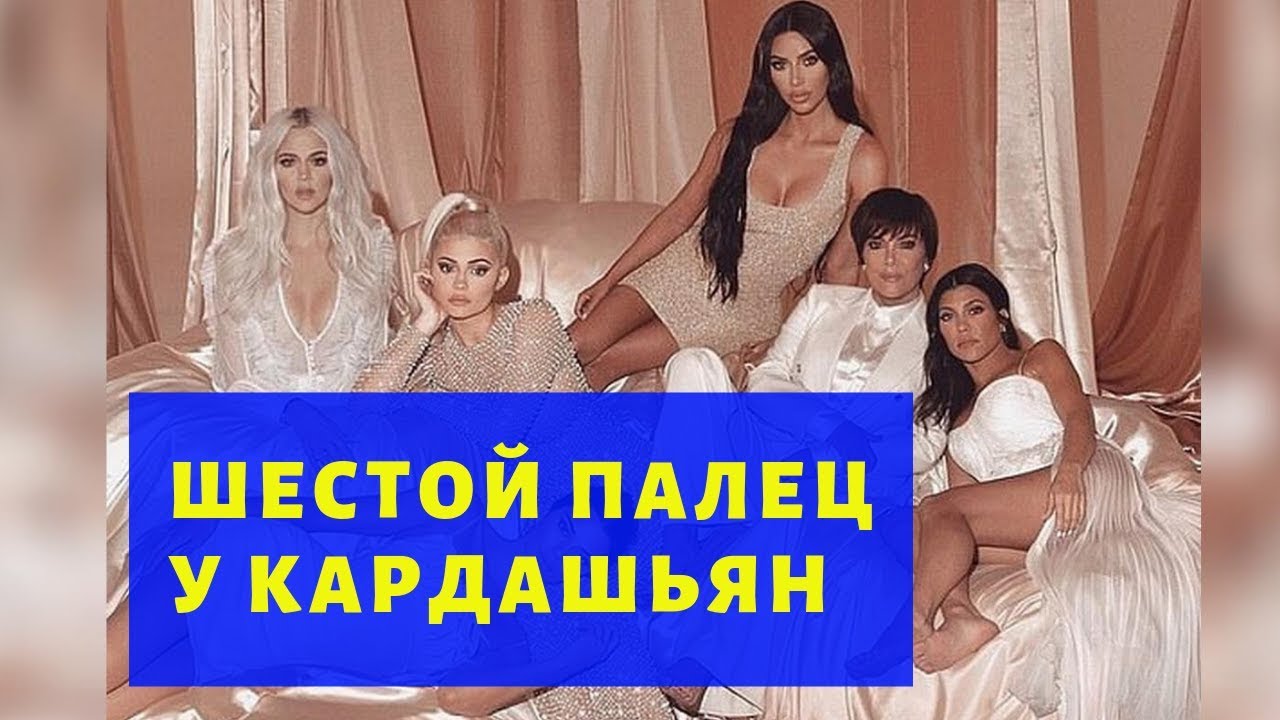 У сестры Кардашьян обнаружили шестой палец У сестры Кардашьян обнаружили шестой палец