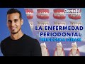 Todo sobre PERIODONTITIS - TRATAMIENTO, síntomas y causas de la enfermedad periodontal | Dentalk! ©