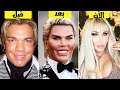 10 اشخاص وصلوا لأقصى الحدود فى عمليات التجميل !