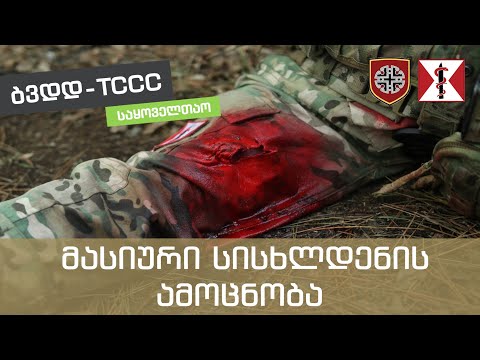 3.  მასიური სისხლდენის ამოცნობა და კონტროლის ძირითადი მეთოდები - [MARCH - M]