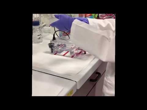 Video: Usando l'elettroforesi su gel di agarosio?