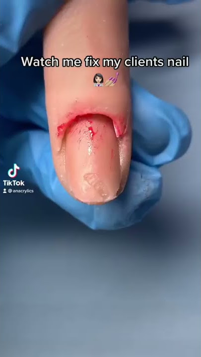 LIHAT AKU MEMPERBAIKI KUKU KLIENKU🤢💅🏼(OMG)😳
