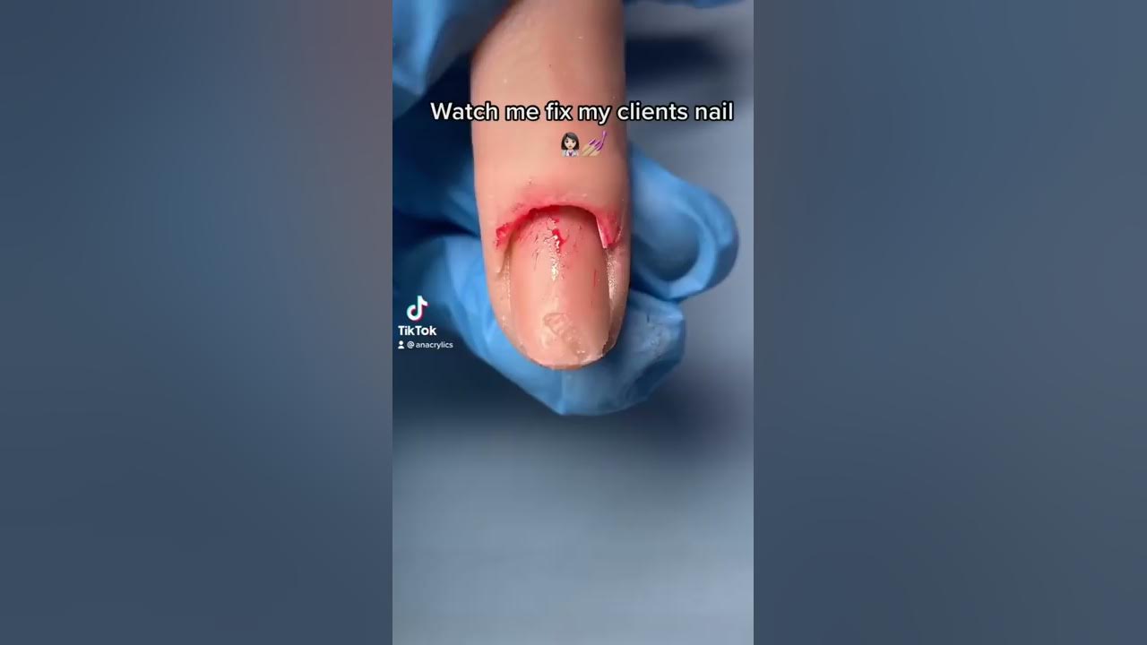 WATCH ME FIX MY CLIENTS NAIL🤢💅🏼(OMG)😳