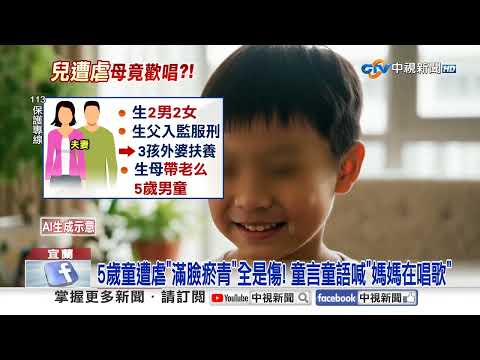 扯! 5歲童遭長期虐打"頭部傷痕累累" 母親竟"在旁唱歌"?│中視新聞 20260127