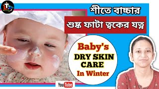 Baby's Winter Dry Skin Care Tips || site bachar toker jotno || Winter Baby Care || Baby Skin Care screenshot 5