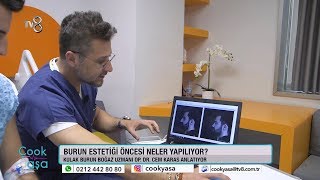 Op. Dr. Cem Karas İle Burun Estetiği Öncesi Yapılan İşlemler