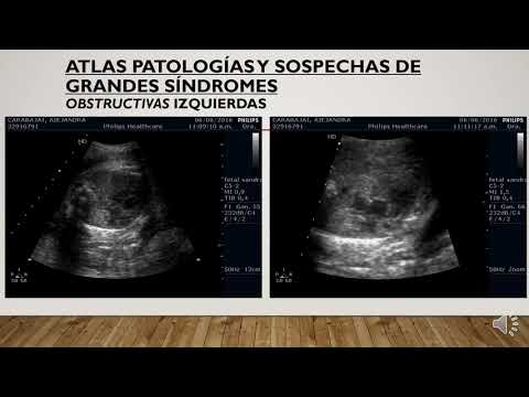 Introducción a la patología cardíaca fetal.