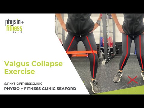 Physio and Fitness Clinic - Easy Valgus Collapse Exercise