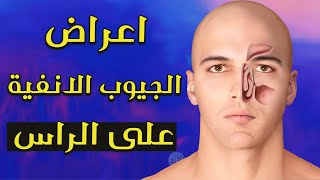 اعراض الجيوب الانفية على الراس .. !