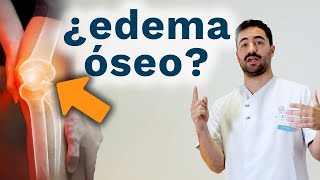 ¿Que es un EDEMA OSEO? -  Tratamiento edema óseo con magnetoterapia